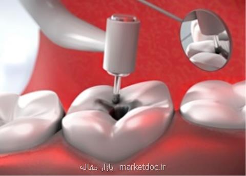 دندان پرشده تان پوسیده شده؟ از این ماده هوشمند كانادایی استفاده كنید