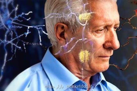 سردرد روی كاركرد فرد اثرگذار است، معضل جدی برای سالمندان