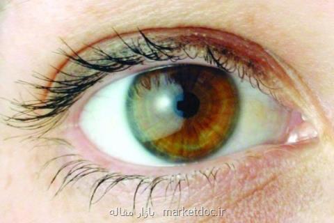 شناسایی مراحل تكوینی تومورهای چشمی در كودكان