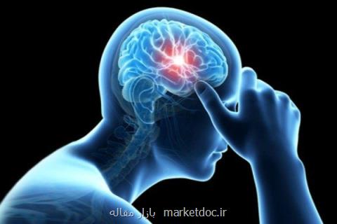 سمپوزیوم تازه های نقشه برداری مغز ایران برگزار می شود