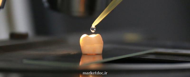 روشی هوشمندانه برای بازسازی مینای دندان